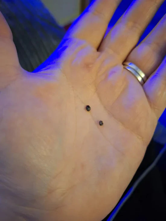 SkinTag - Snabb och smärtfri hudflikborttagning hemma